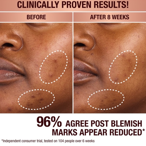 Charlotte Tilbury Dark Spot Correcting Radiance Recovery Serum 30ml - Picture 5 of 12